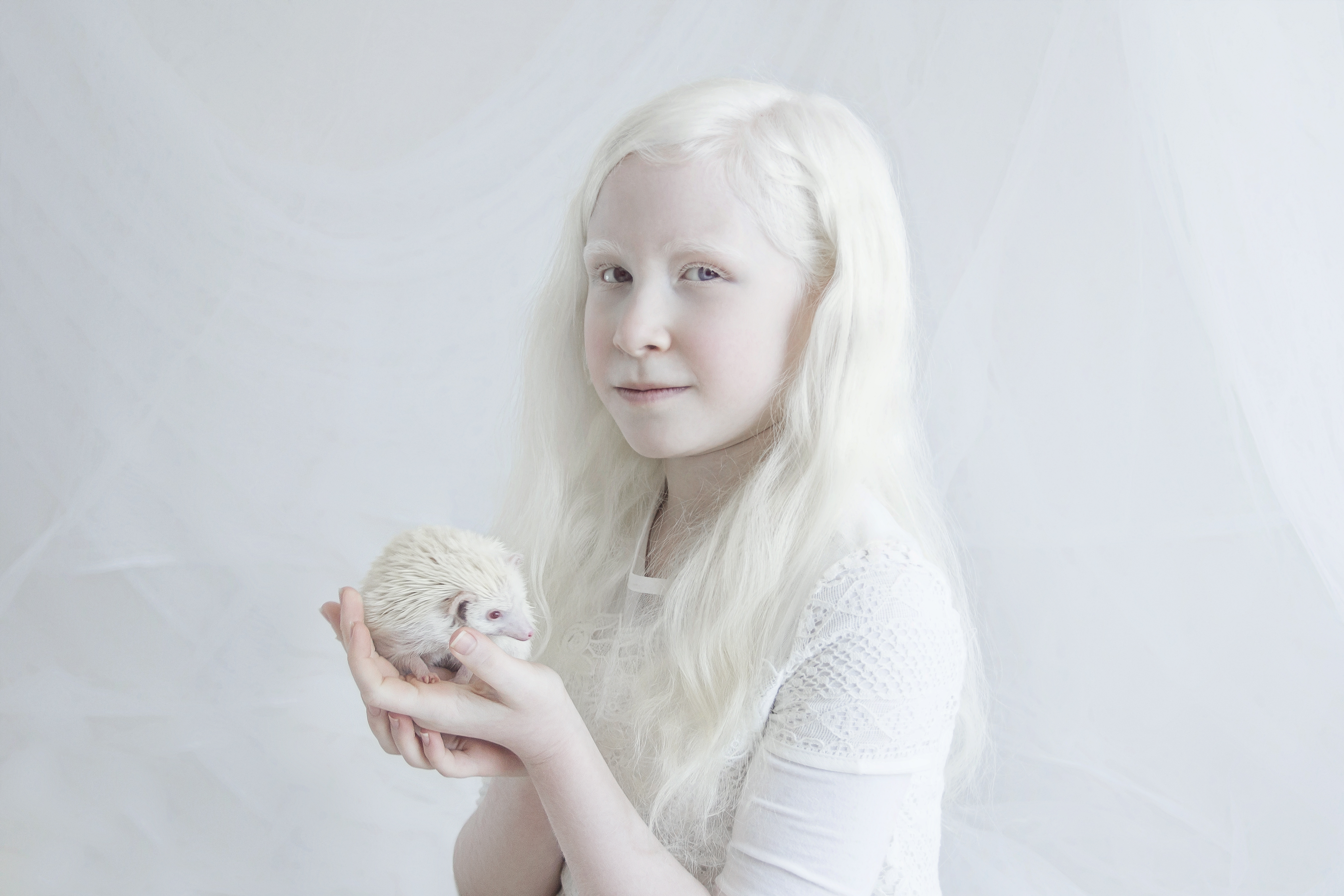 Как люди рождаются альбиносами. Саша Смирнов альбинос. Седые альбиносы.